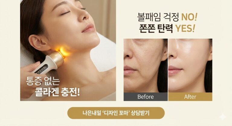[처진 피부 탄력] 인모드 포마(Forma) 집중 분석: 통증 없는 콜라겐 리모델링 원리 핵심 1가지