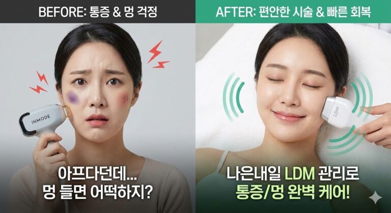 인모드 통증, 솔직히 어느 정도? (멍, 붓기 최소화하는 노하우 + LDM 관리) 2가지 모드 차이 알아보기