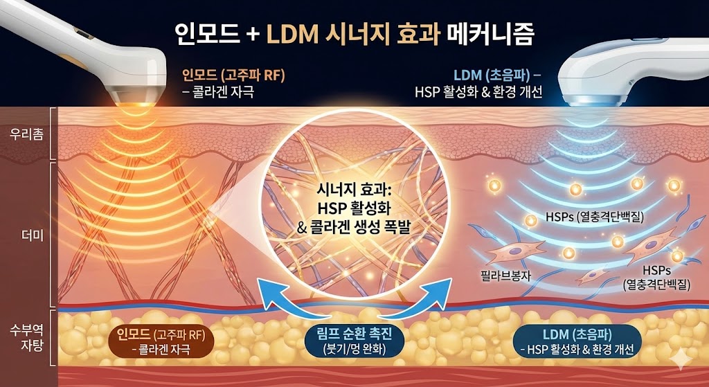 인모드 + LDM 시너지 효과 다이어그램. 인모드(고주파)와 LDM(초음파)이 피부 진피층에 함께 작용하여 HSPs 활성화 및 콜라겐 생성이 증폭되는 과정을 시각화. 또한, 림프 순환 촉진으로 붓기/멍이 빠르게 완화되는 모습도 포함.