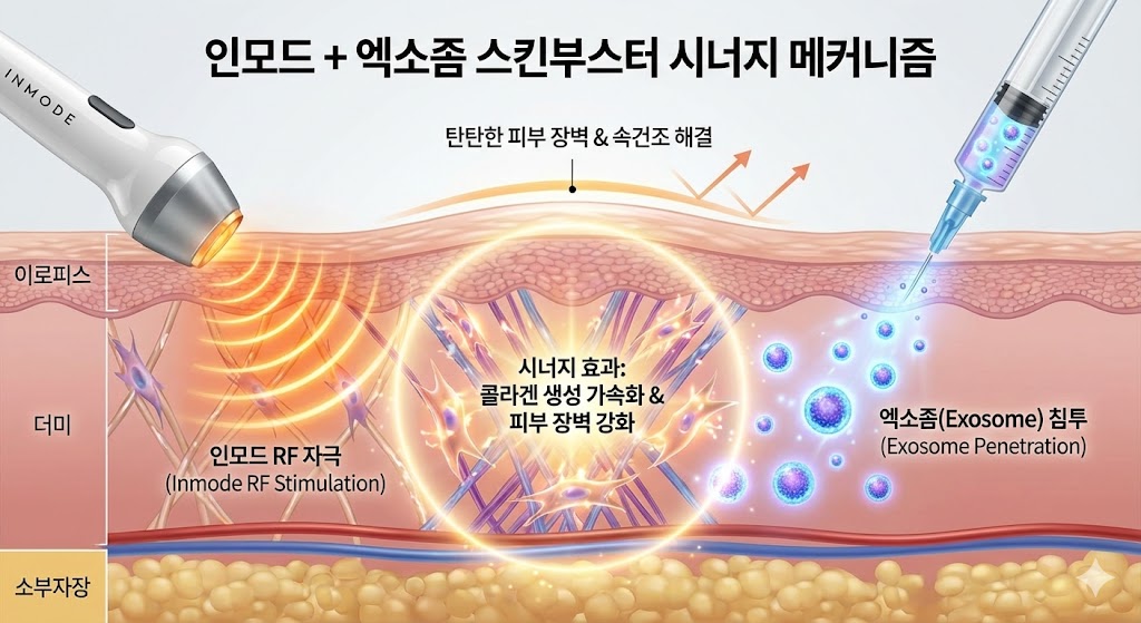 인모드 + 스킨부스터(엑소좀) 시너지 효과. 인모드로 자극받은 진피층에 엑소좀 성분(반짝이는 입자)이 침투하여 콜라겐 생성 속도가 빨라지고 피부 장벽이 강화되는 모습을 시각화.