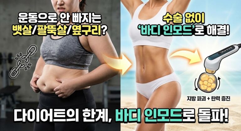 [송도 바디 인모드] 운동해도 안 빠지는 뱃살/팔뚝살 제거 원리 (비수술 지방파괴술) 딱 이 글 1개만 보세요