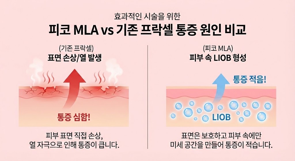 🖼️ [이미지 삽입 구간 1]  이미지 설명: 기존 프락셀 vs 피코 MLA 통증 원인 비교 다이어그램.  (기존 프락셀): 피부 표면에 직접적인 손상(깎임/열)이 발생하여 통증이 심함을 시각화.  (피코 MLA): 피부 표면은 보호되고 피부 속에만 LIOB가 형성되어 통증이 적음을 시각화.