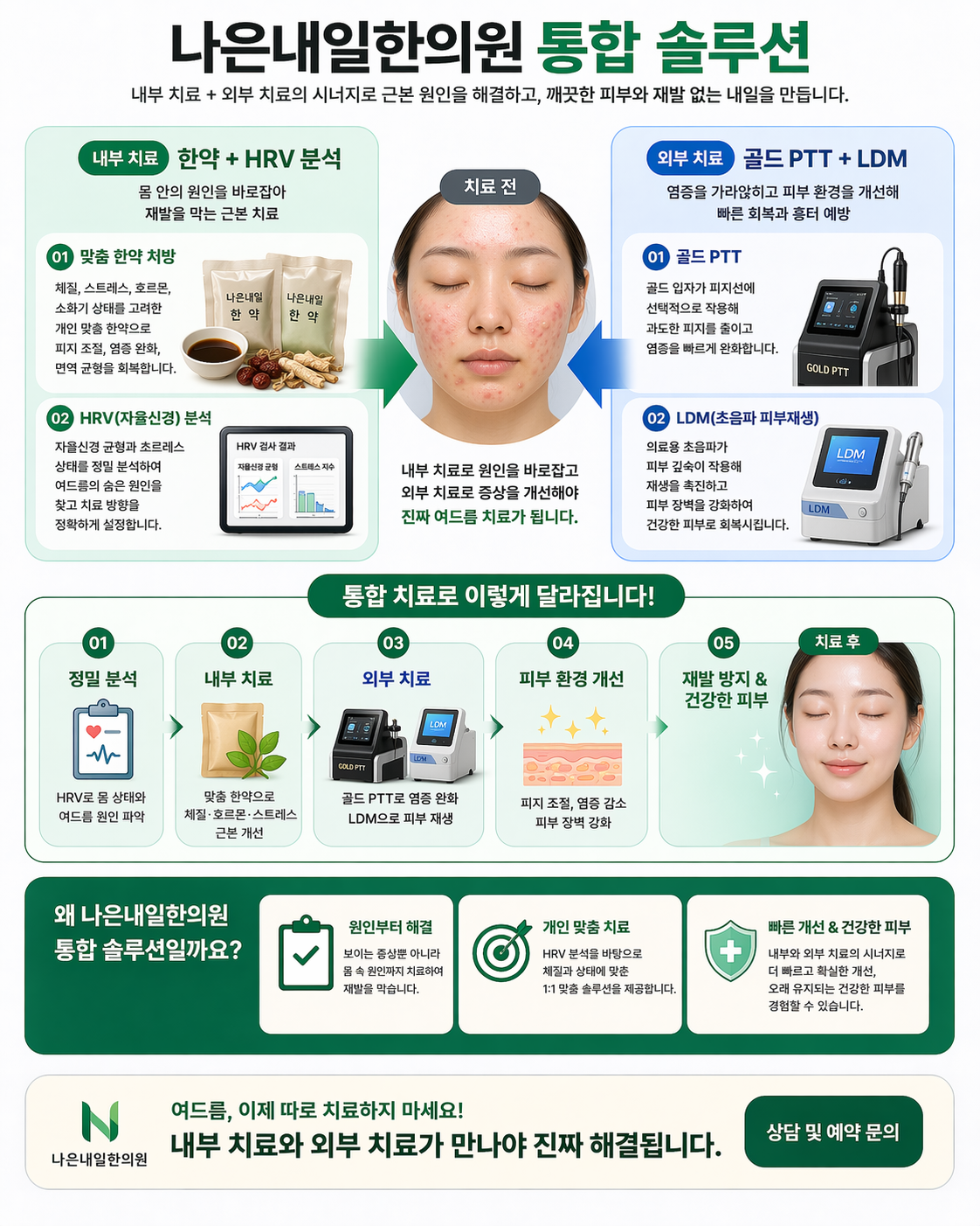 송도 여드름 약